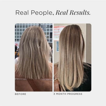 hair growth support, JSHealth alternative